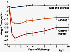 Bariatric graph