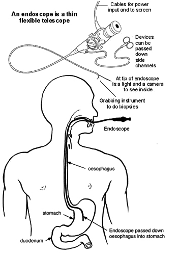 gastroscopy img